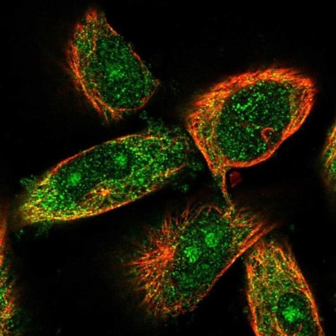 Immunocytochemistry/Immunofluorescence: CCBL2 Antibody [NBP1-87387] - Staining of human cell line U-251 MG shows positivity in nucleoli & cytoplasm.