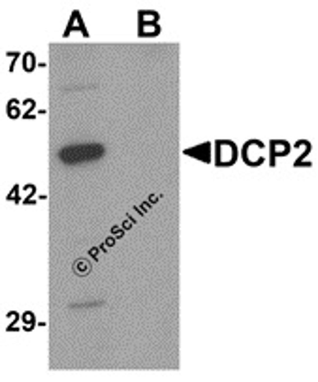 Western blot analysis of DCP2 in 293 cell lysate with DCP2 antibody at 1 μg/mL in (A) the absence and (B) the presence of blocking peptide.