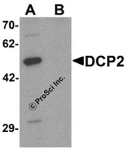 Western blot analysis of DCP2 in 293 cell lysate with DCP2 antibody at 1 μg/mL in (A) the absence and (B) the presence of blocking peptide.