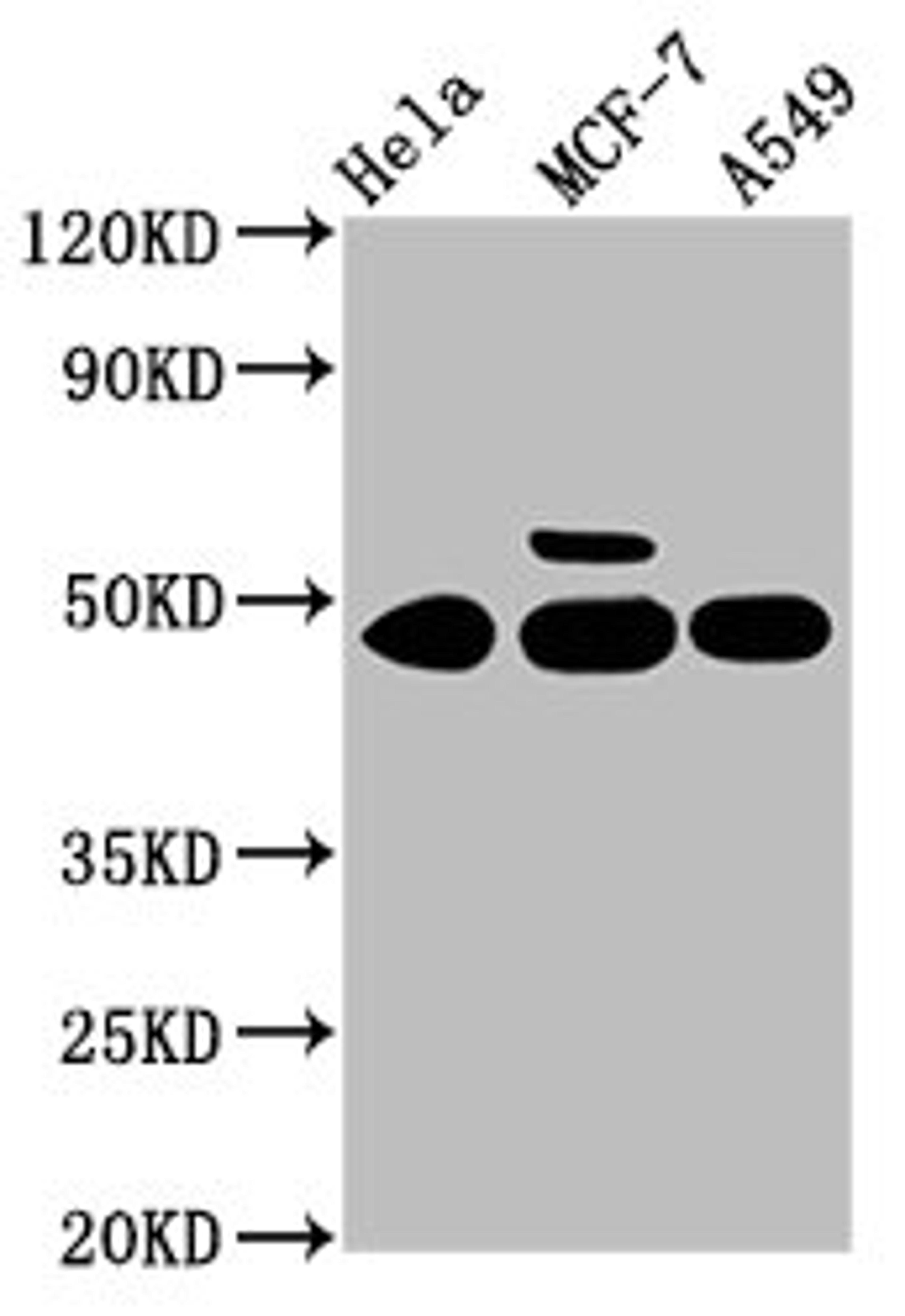 Western Blot. Positive WB detected in: Hela whole cell lysate, MCF-7 whole cell lysate, A549 whole cell lysate. All lanes: CSNK1G1 antibody at 3.4µg/ml. Secondary. Goat polyclonal to rabbit IgG at 1/50000 dilution. Predicted band size: 49, 46 kDa. Observed band size: 49 kDa