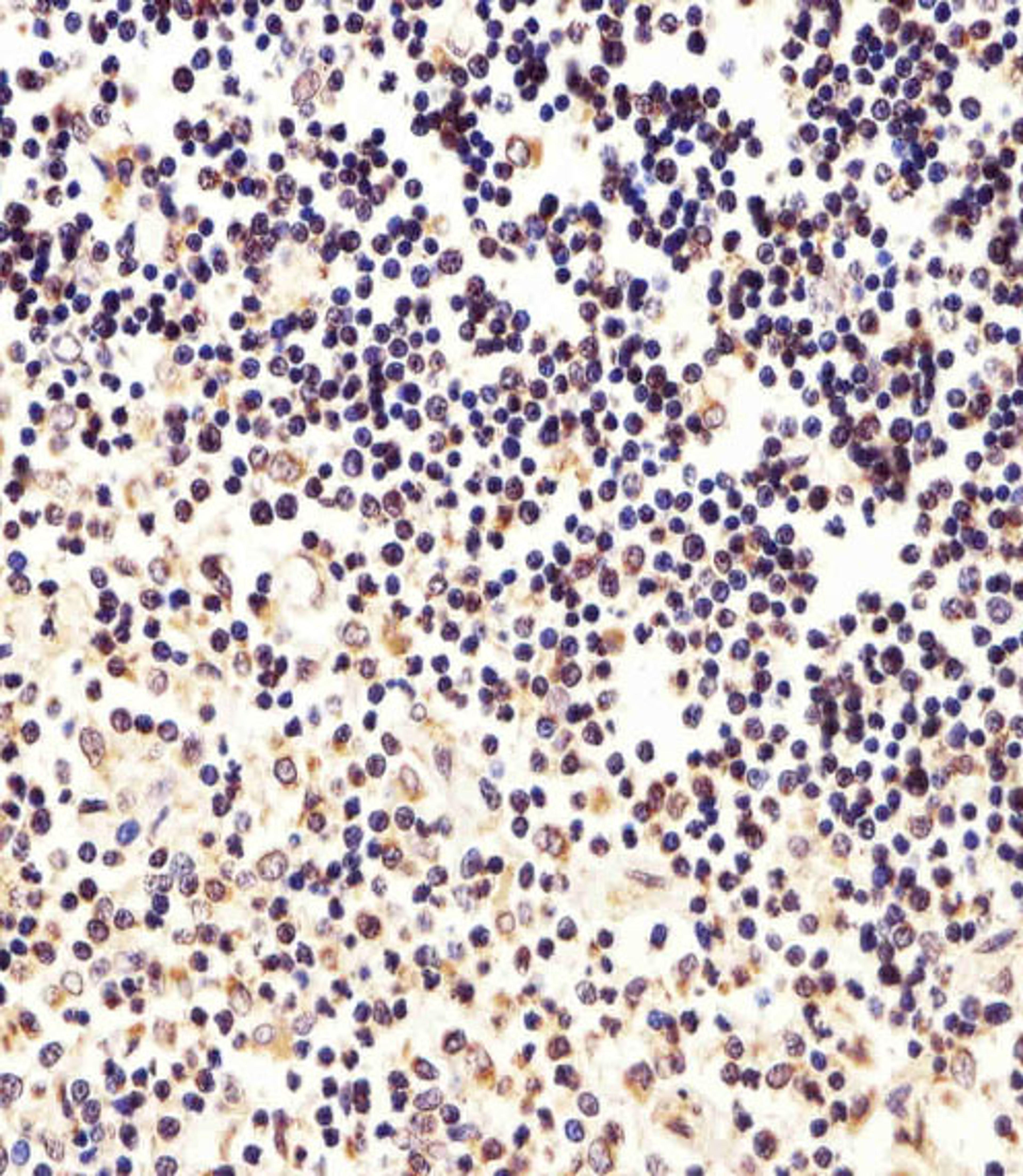 Immunohistochemical analysis of paraffin-embedded H. thymus section using FOXP1 Antibody . Antibody was diluted at 1:25 dilution. A undiluted biotinylated goat polyvalent antibody was used as the secondary, followed by DAB staining.