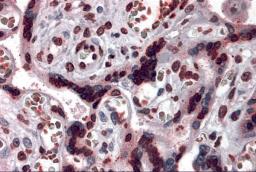 Immunohistochemistry of CARMA2 in human placenta tissue with CARMA2 antibody at 5 &#956;g/mL.