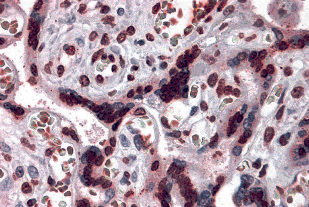 Immunohistochemistry of CARMA2 in human placenta tissue with CARMA2 antibody at 5 μg/mL.