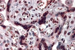 Immunohistochemistry of CARMA2 in human placenta tissue with CARMA2 antibody at 5 μg/mL.