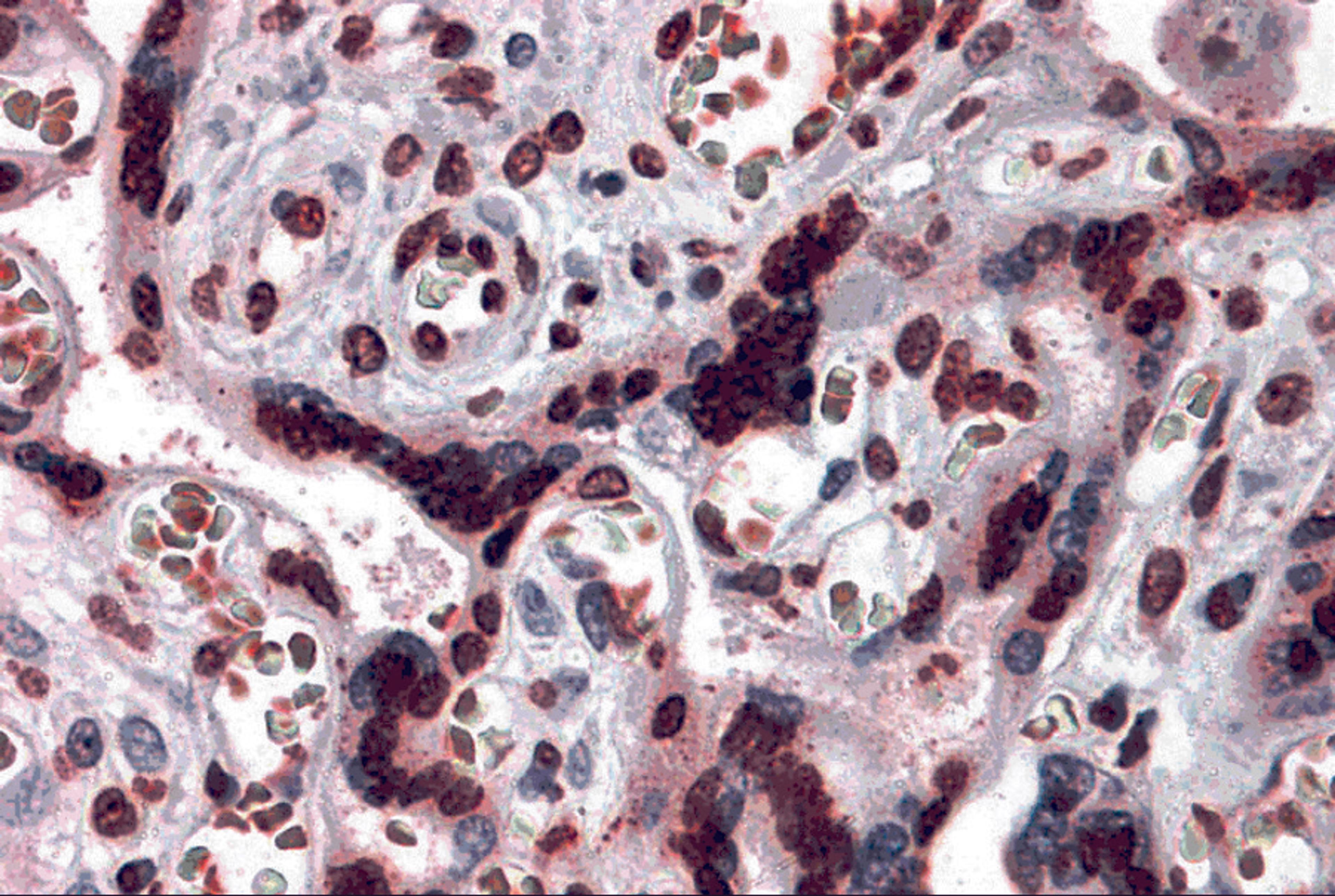 Immunohistochemistry of CARMA2 in human placenta tissue with CARMA2 antibody at 5 μg/mL.