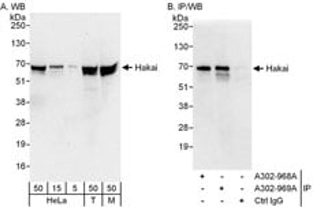 Detection of human and mouse Hakai by western blot (h&m) and immunoprecipitation (h).