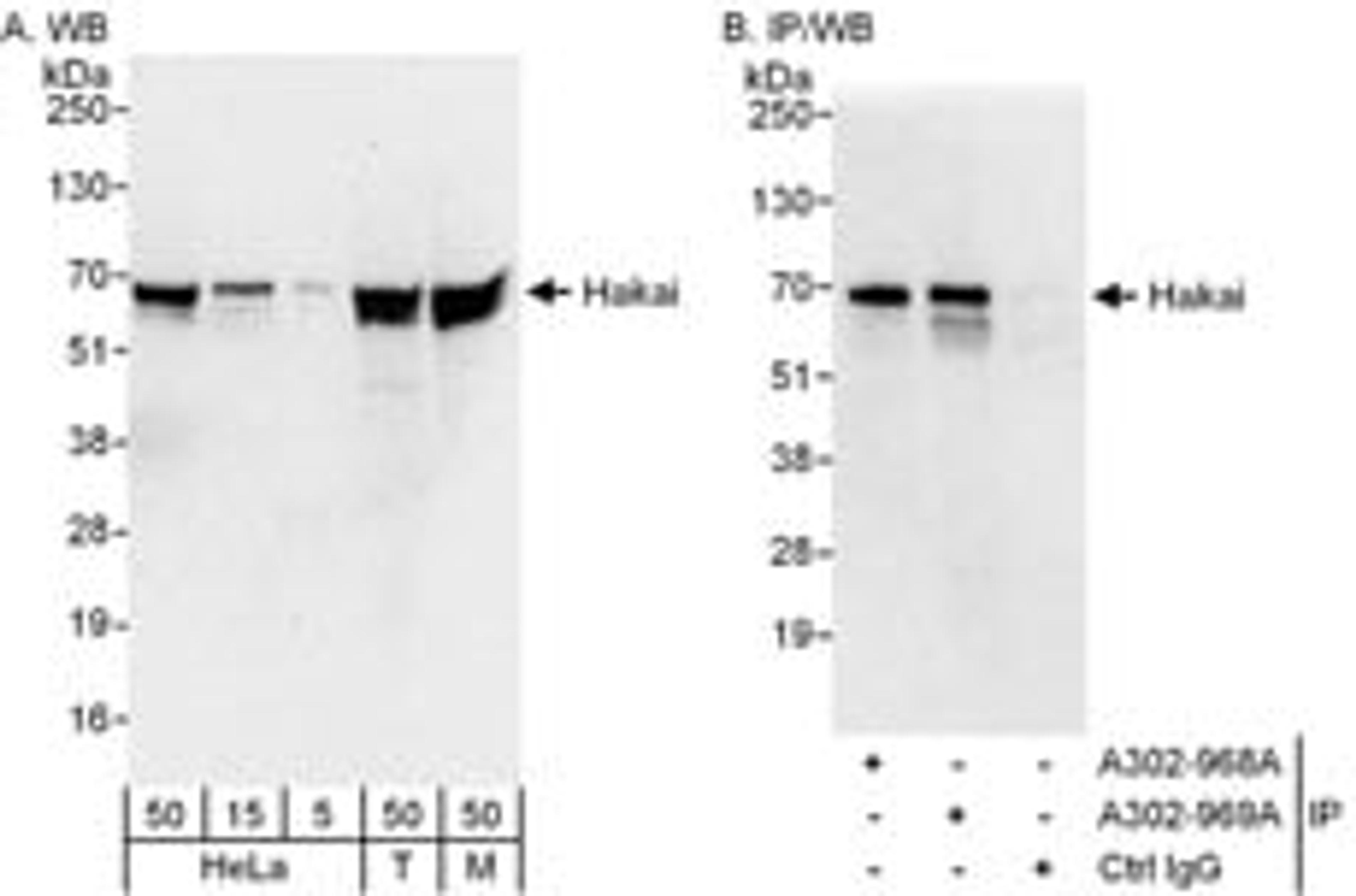 Detection of human and mouse Hakai by western blot (h&m) and immunoprecipitation (h).