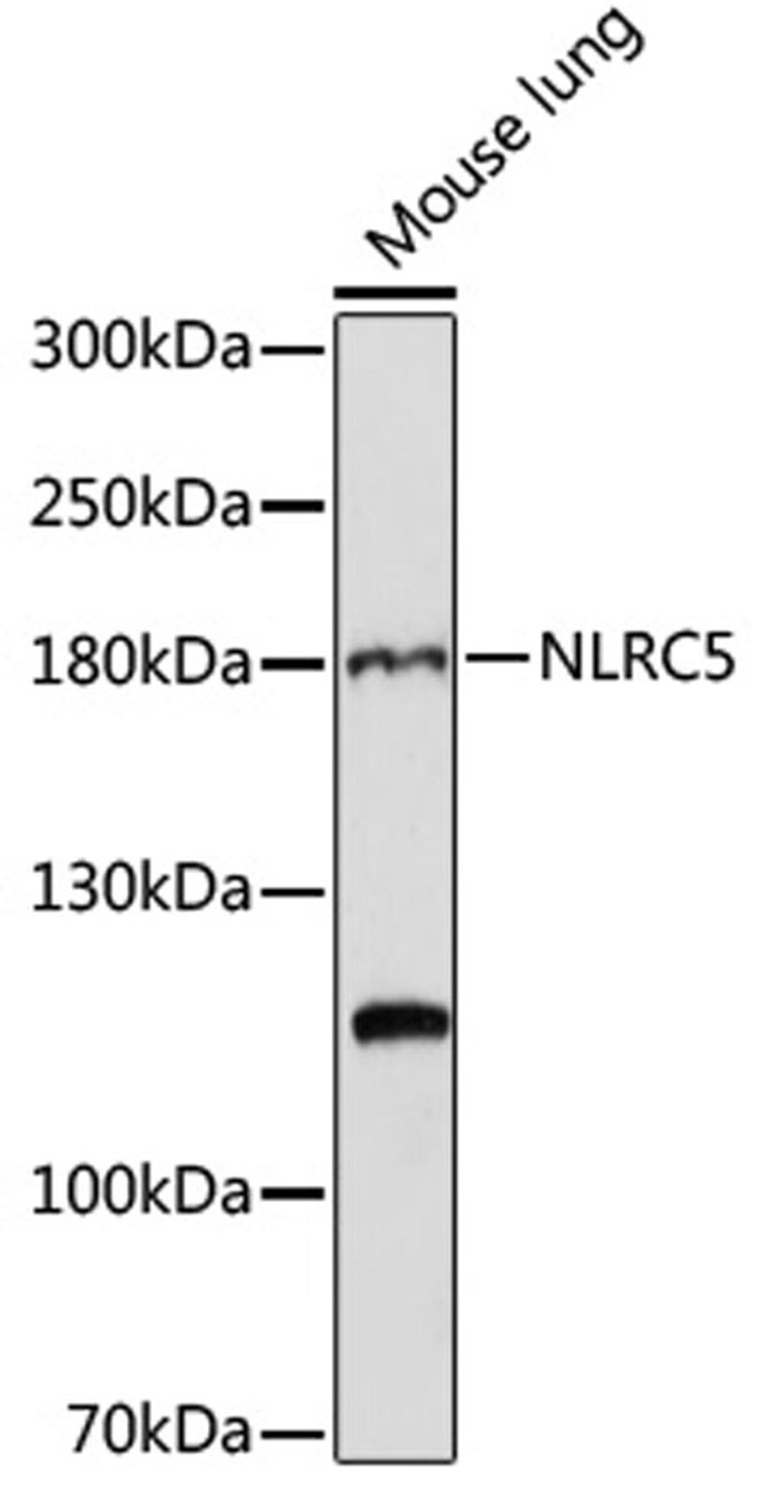 Western blot - NLRC5 antibody (A16710)