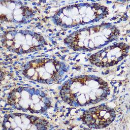 Immunohistochemistry  - TEX101 Rabbit pAb (A18118)