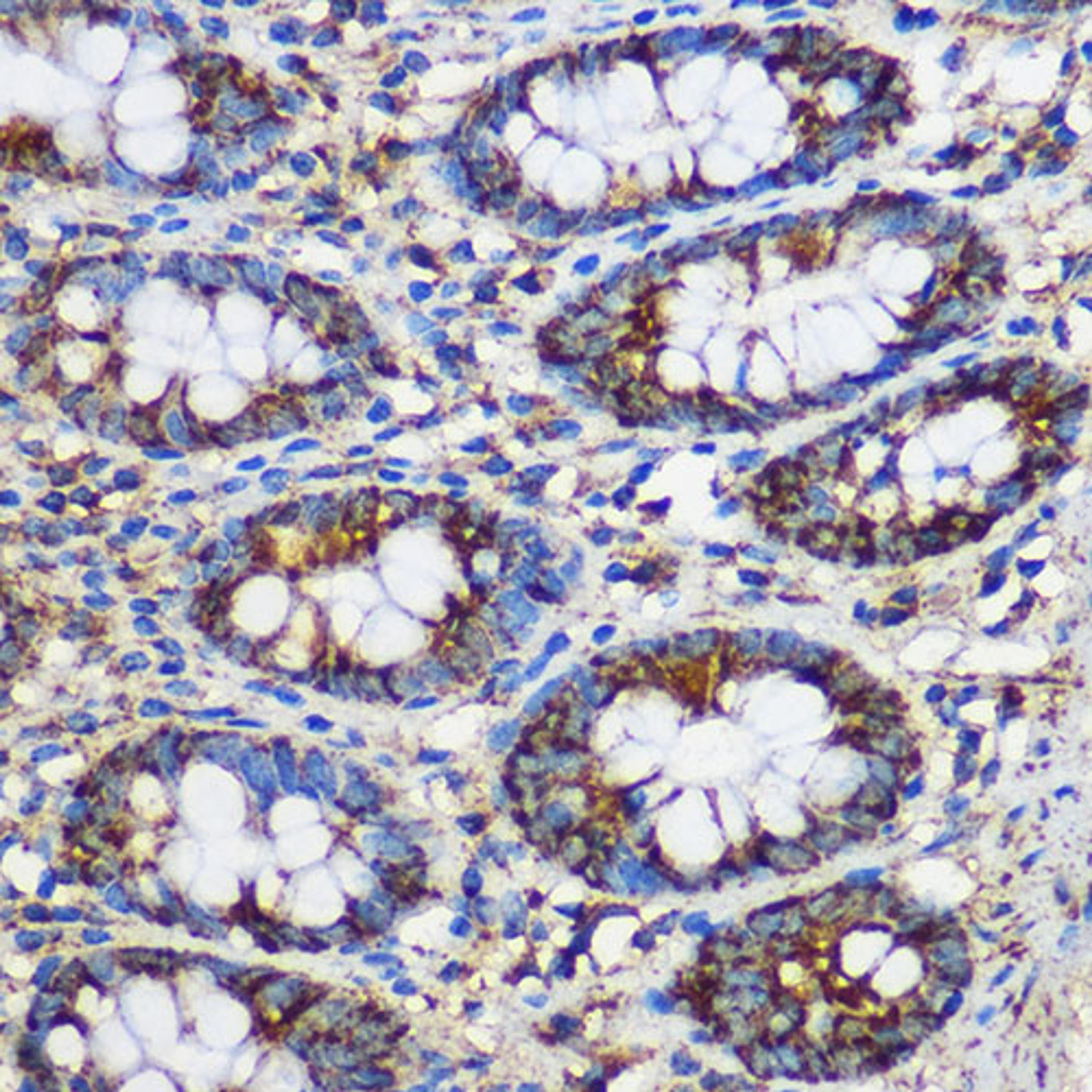 Immunohistochemistry - TEX101 Rabbit pAb (A18118)
