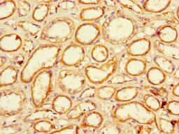Immunohistochemistry of paraffin-embedded human kidney tissue using CSB-PA706635LA01HU at dilution of 1:100