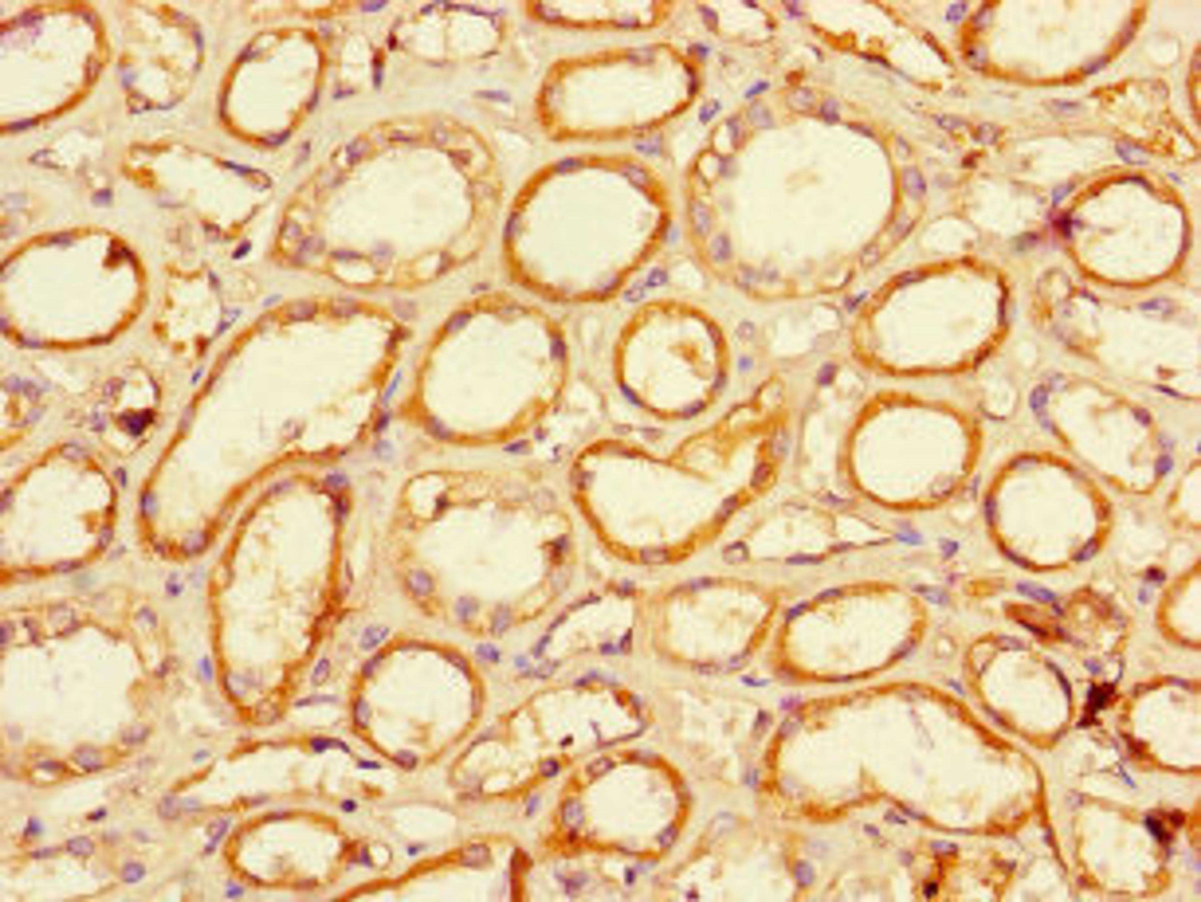 Immunohistochemistry of paraffin-embedded human kidney tissue using CSB-PA706635LA01HU at dilution of 1:100
