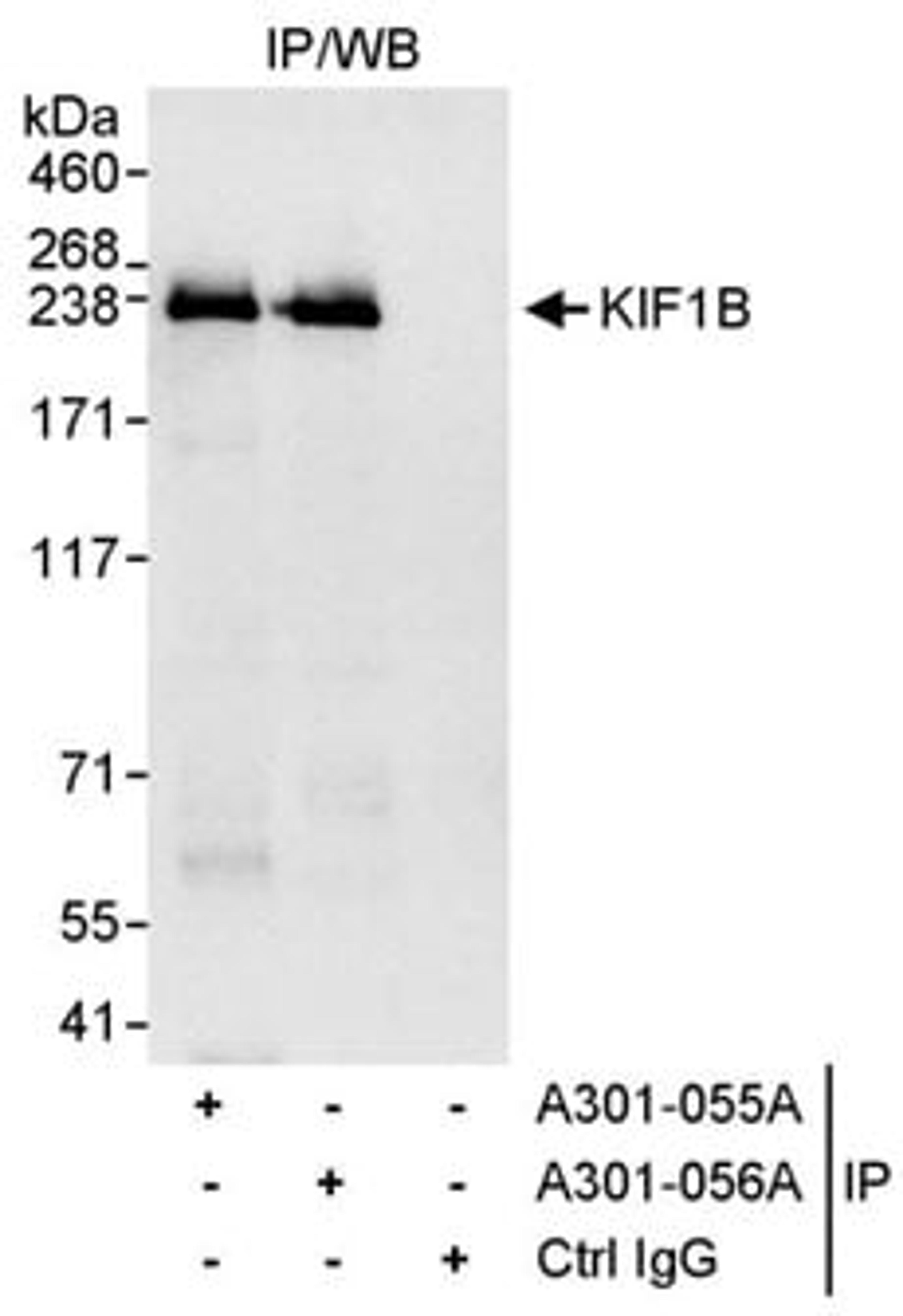 Detection of human KIF1B by western blot of immunoprecipitates.