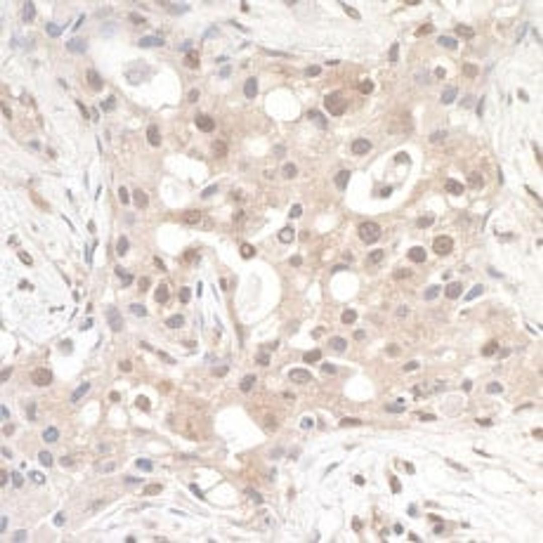 Detection of human RABGEF1 by immunohistochemistry.