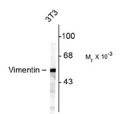 Western blot of NIH 3T3 cells showing specific immunolabeling of the ~50k Vimentin protein.<br><br><b>Below: </b>Mixed neuron/glial cultures stained with anti-Vimentin (green) and rabbit anti-GFAP antibody (red). Vimentin is expressed alone in fibroblasti