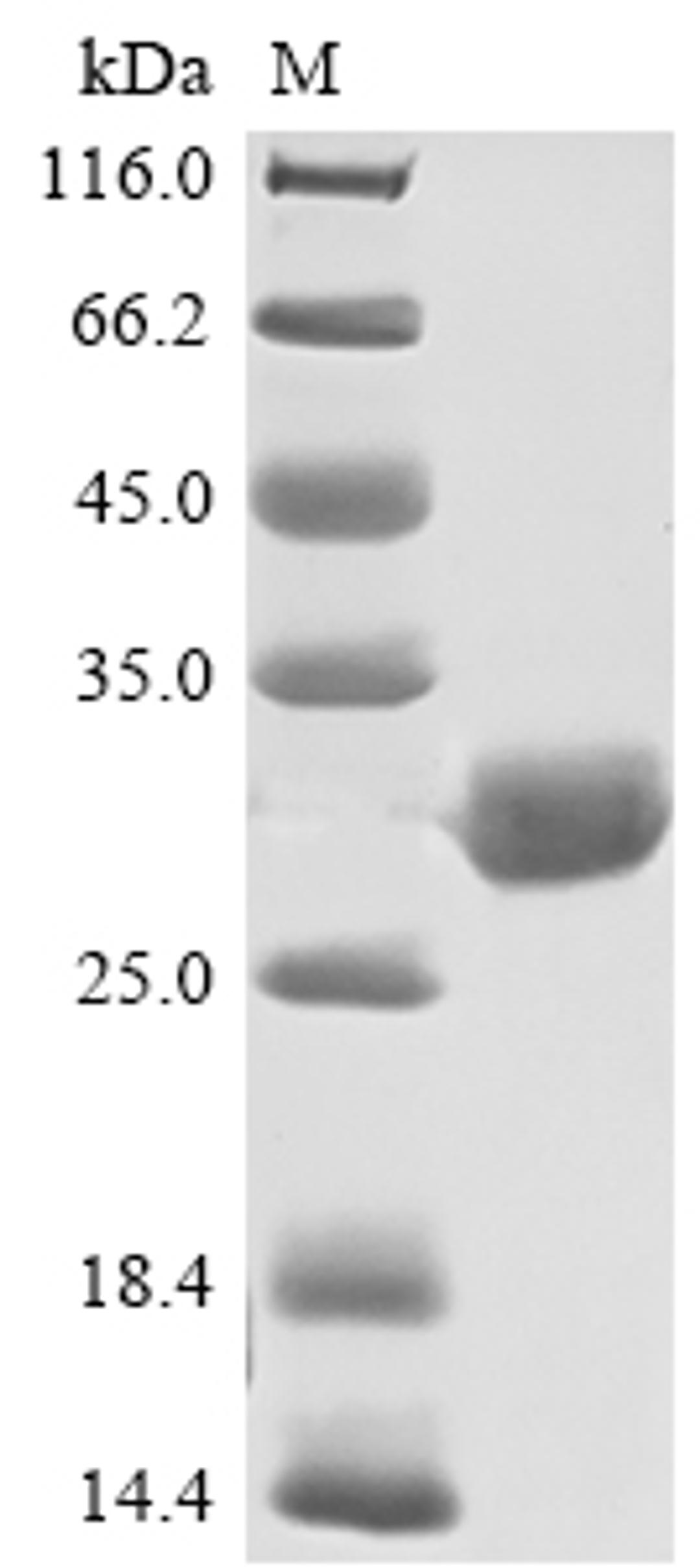 (Tris-Glycine gel) Discontinuous SDS-PAGE (reduced) with 5% enrichment gel and 15% separation gel.