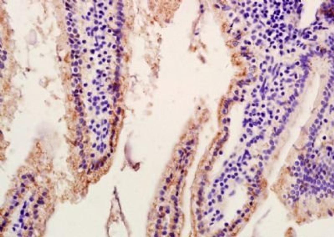 Immunohistochemical analysis of formalin-fixed and paraffin embedded human placenta tissue (Dilution at:1:200) using SLC10A2 antibody