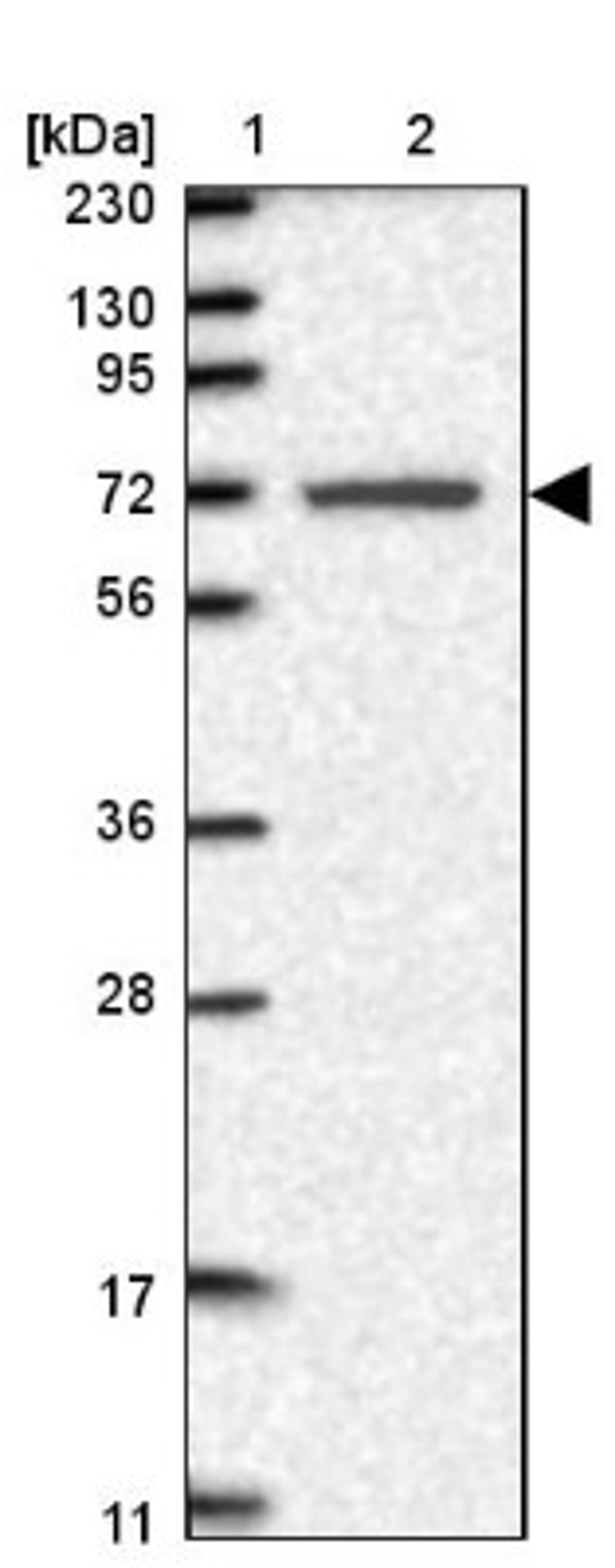 Western Blot: LRRC40 Antibody [NBP1-82185] - Lane 1: Marker [kDa] 230, 130, 95, 72, 56, 36, 28, 17, 11<br/>Lane 2: Human cell line RT-4