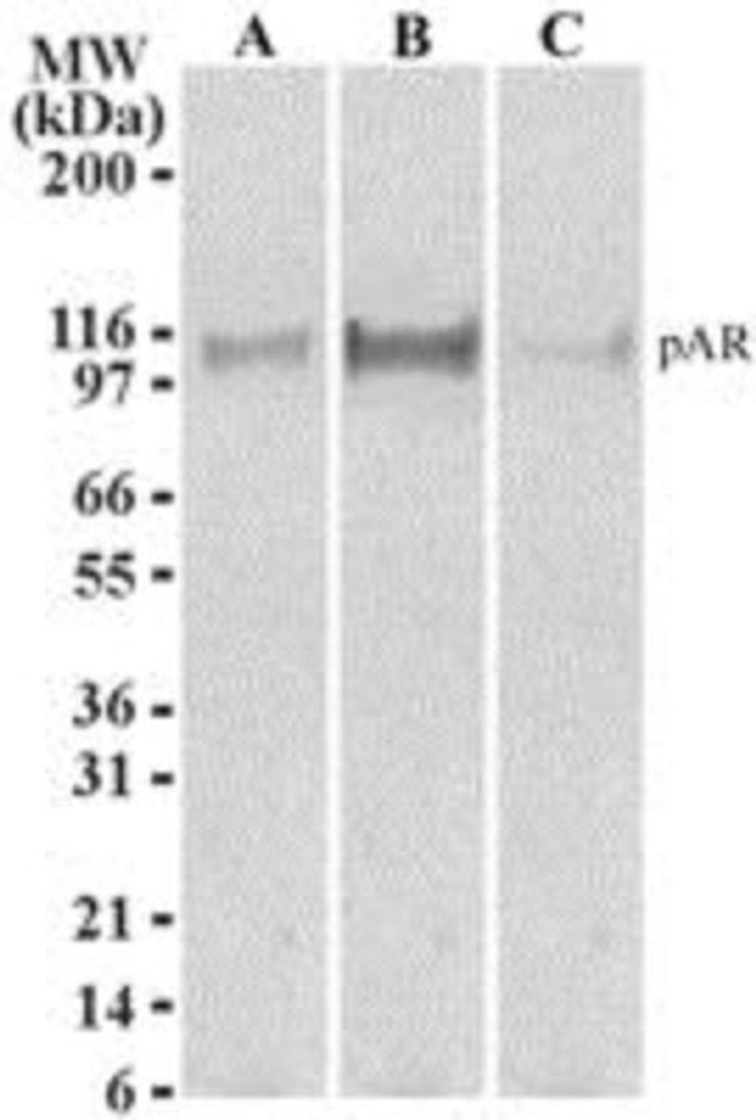 Western Blot: Androgen Receptor [p Ser213, p Ser210] Antibody (156C135.2) [NB100-56603] - LNCaP cells (passage number 38) were serum-starved for 2 days.  After serum starvation, cells were (A) left untreated, (B) treated with 100 ng/ml IGF-1 for 4h, or (C) incubated with 20 um LY294002 for 30 min prior to treatment with 100 ng/ml IGF-1 for 4 h. (See Lin, H-K., Y-C Hu, L. Yang, S. Altuwaijri. 2003 Fig. 2)