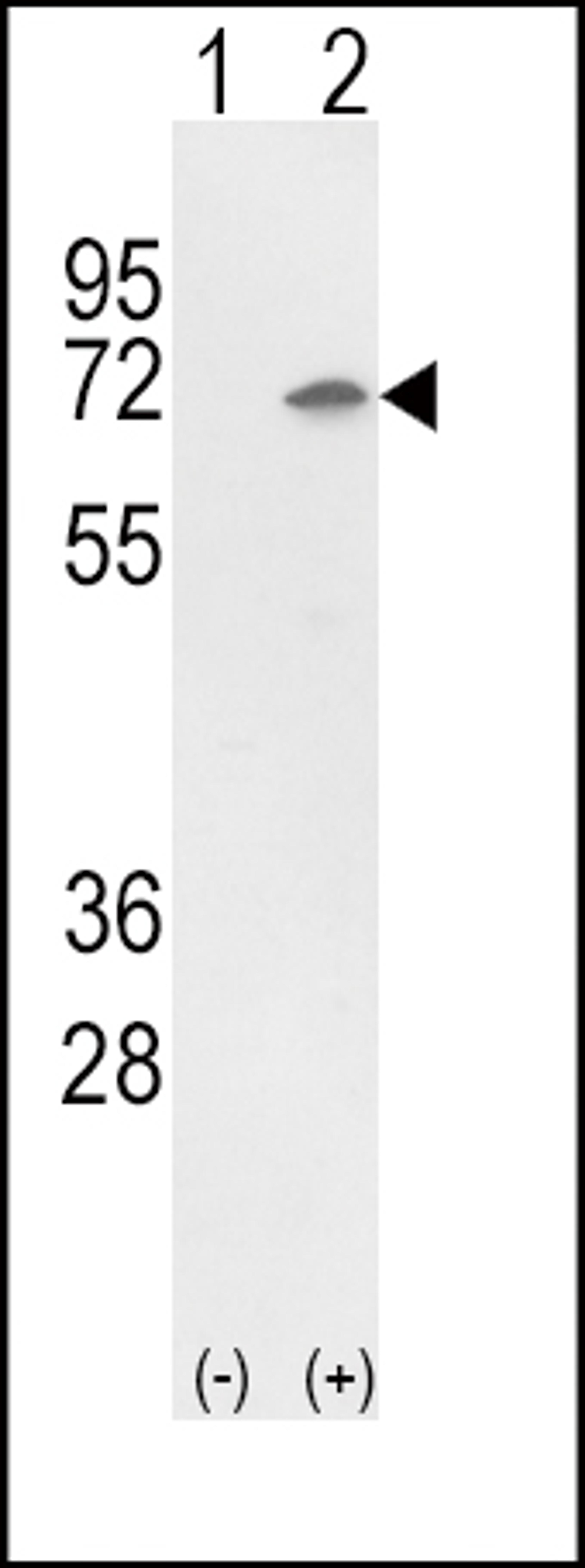 Western blot analysis of Ku70 using rabbit polyclonal Ku70 Antibody using 293 cell lysates (2 ug/lane) either nontransfected (Lane 1) or transiently transfected with the Ku70 gene (Lane 2).