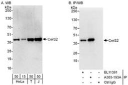 Detection of human CerS2 by western blot and immunoprecipitation.