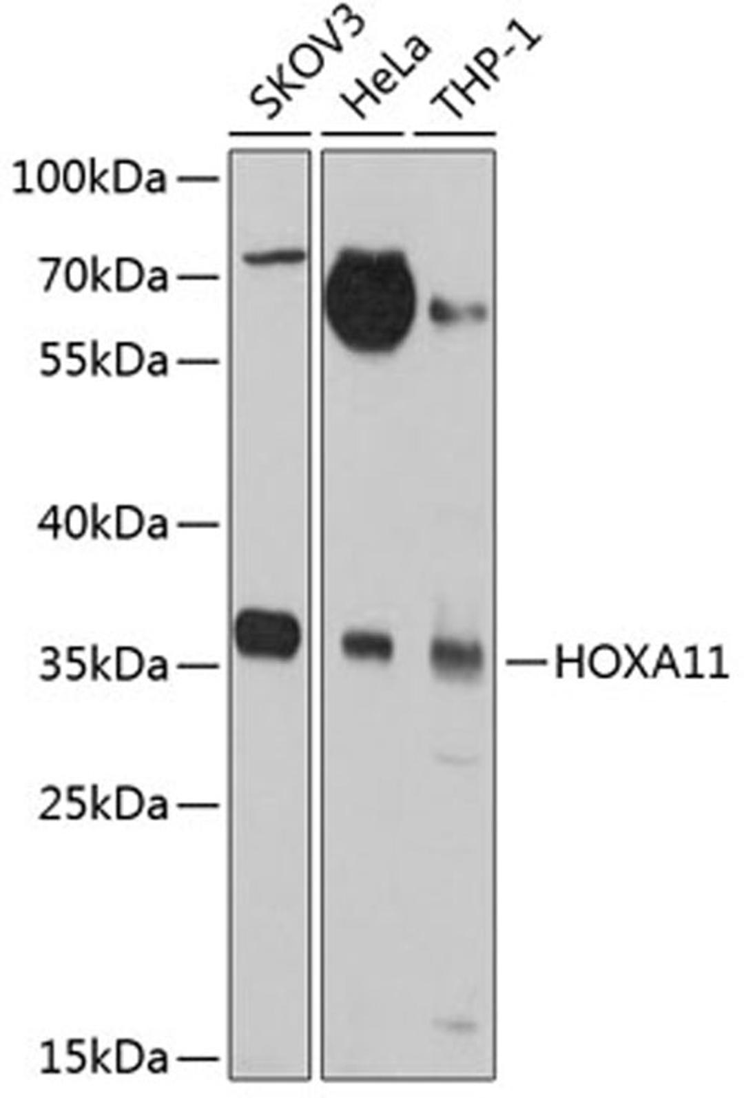 Western blot - HOXA11 antibody (A2976)
