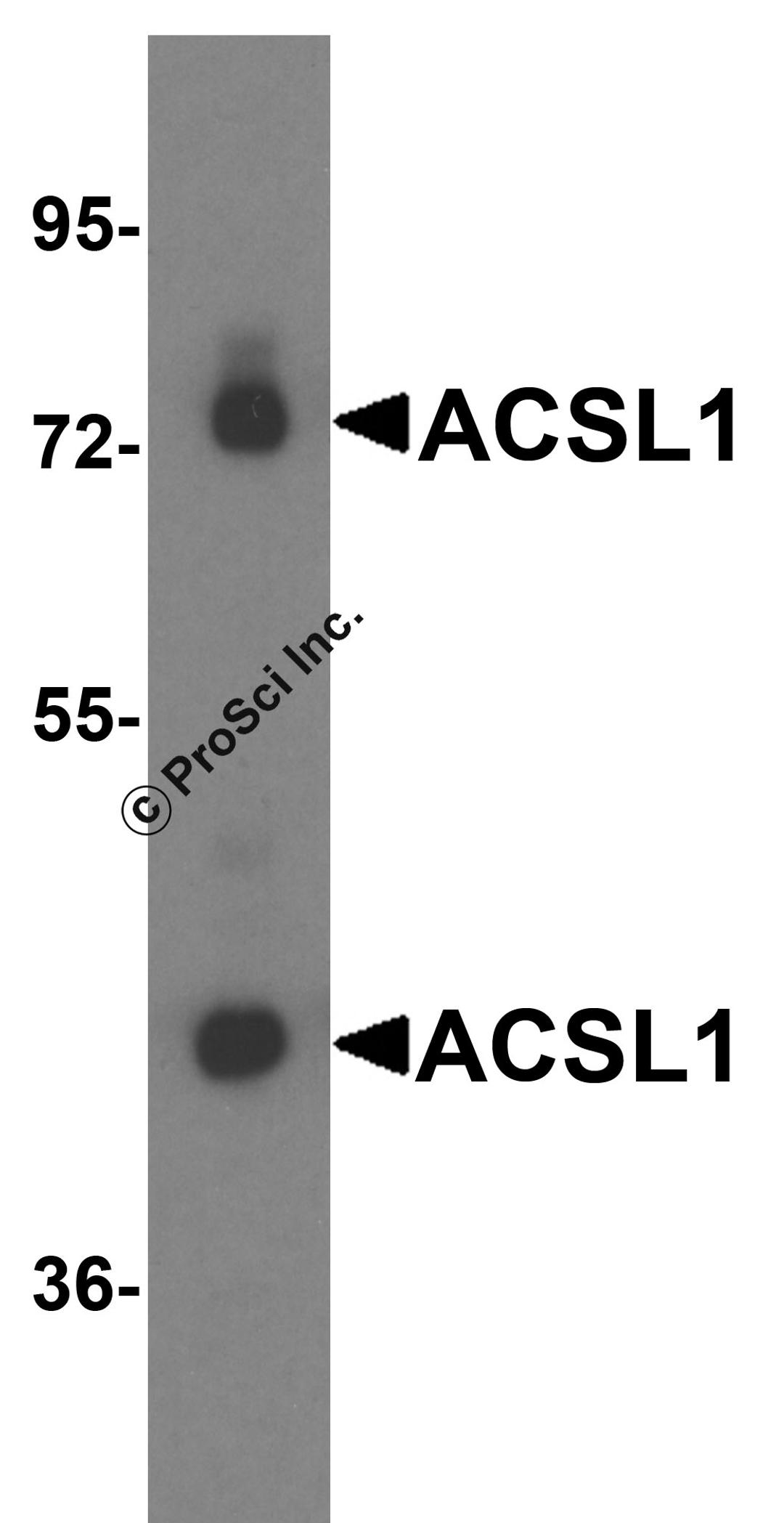 Western blot analysis of ACSL1 expression in human liver tissue lysate with ACSL1 antibody at 0.25 μg/ml.