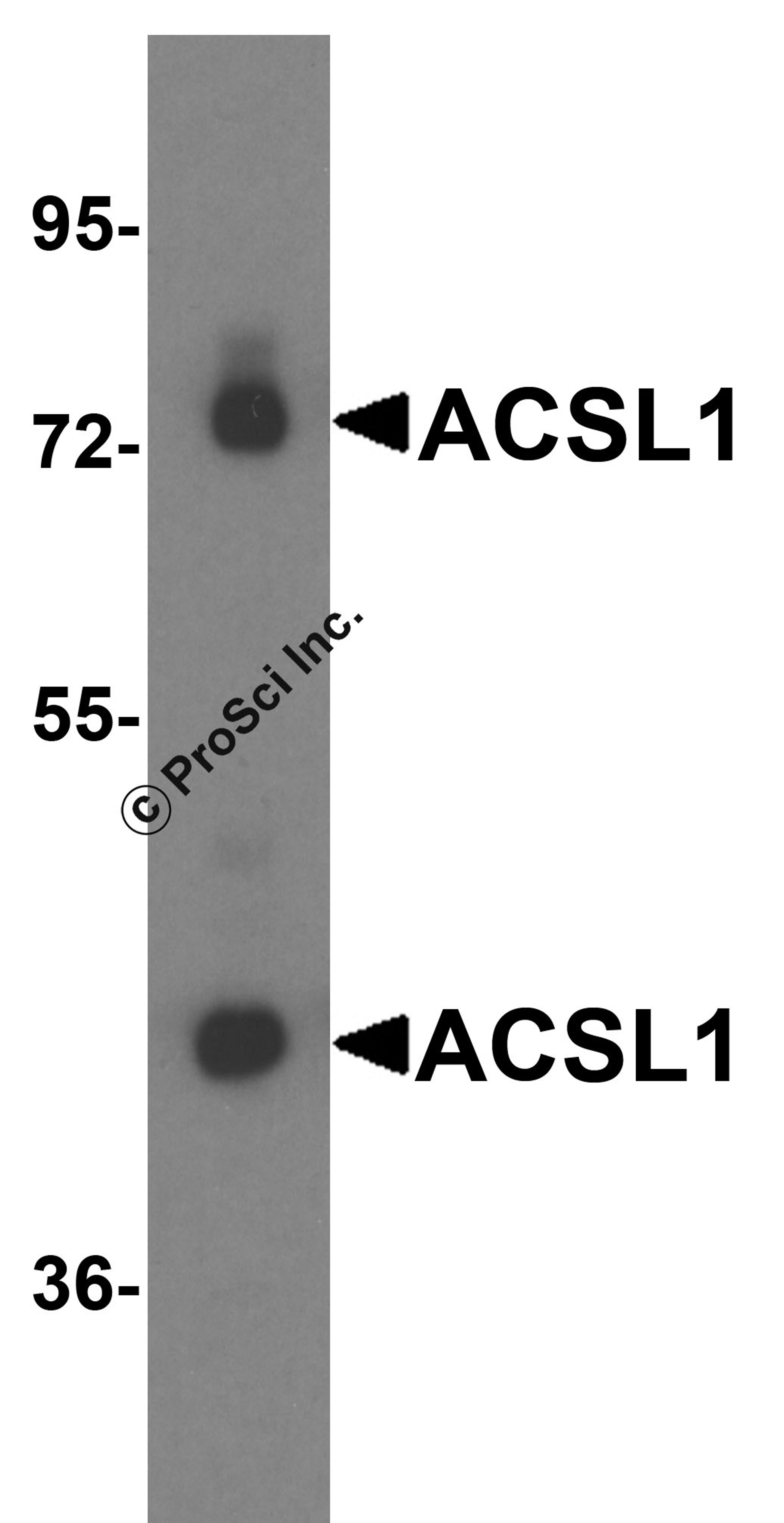 Western blot analysis of ACSL1 expression in human liver tissue lysate with ACSL1 antibody at 0.25 μg/ml.