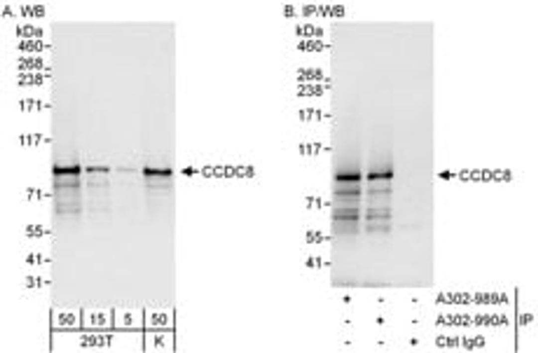 Detection of human CCDC8 by western blot and immunoprecipitation.