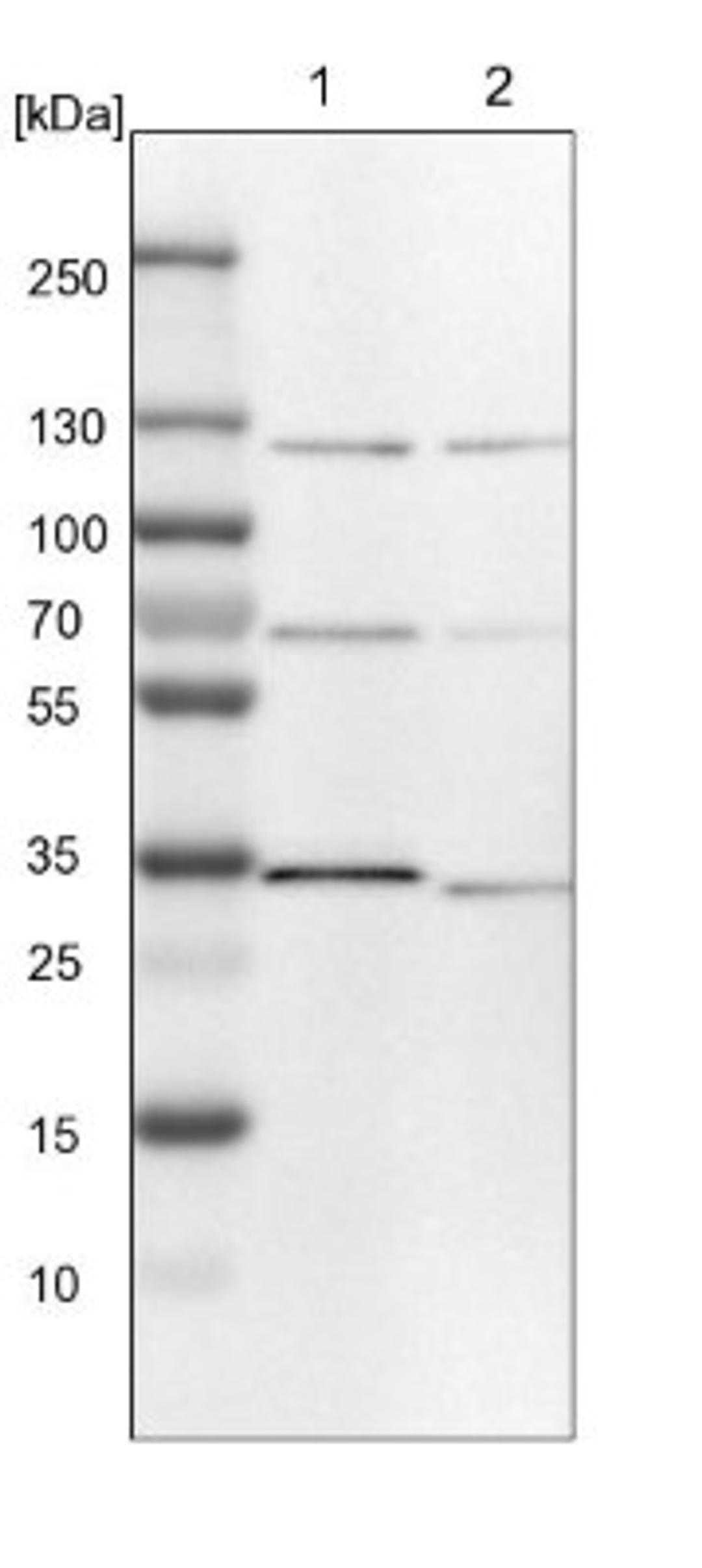 Western Blot: TOM1L2 Antibody [NBP1-86006] - Lane 1: NIH-3T3 cell lysate (Mouse embryonic fibroblast cells)<br/>Lane 2: NBT-II cell lysate (Rat Wistar bladder tumour cells)