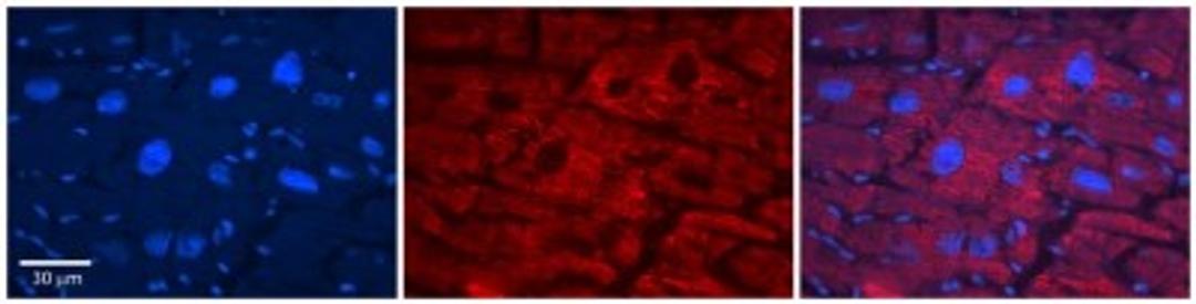 Immunohistochemistry: Acetyl-coenzyme A transporter 1 Antibody [NBP1-59882] - Human Adult heart Observed Staining: Cytoplasmic,Membrane Primary Antibody Concentration: 1 : 600 Secondary Antibody: Donkey anti-Rabbit-Cy2/3 Secondary Antibody Concentration: 1 : 200 Magnification: 20X Exposure Time: 0.5 2.0 sec.