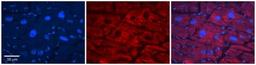 Immunohistochemistry: Acetyl-coenzyme A transporter 1 Antibody [NBP1-59882] - Human Adult heart Observed Staining: Cytoplasmic,Membrane Primary Antibody Concentration: 1 : 600 Secondary Antibody: Donkey anti-Rabbit-Cy2/3 Secondary Antibody Concentration: 1 : 200 Magnification: 20X Exposure Time: 0.5 2.0 sec.