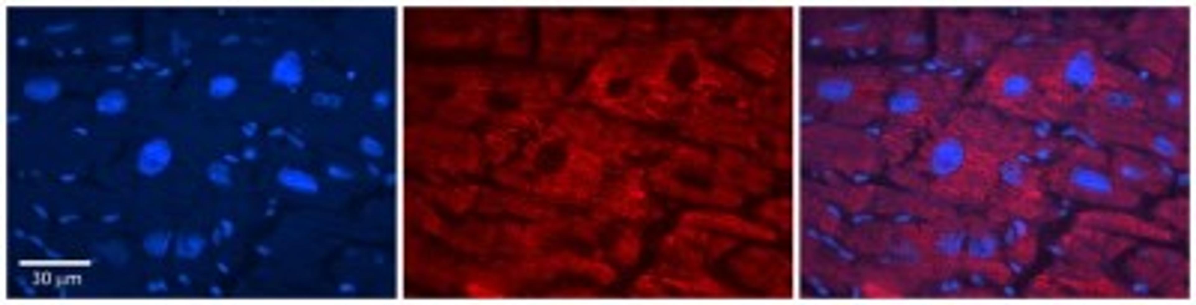 Immunohistochemistry: Acetyl-coenzyme A transporter 1 Antibody [NBP1-59882] - Human Adult heart Observed Staining: Cytoplasmic,Membrane Primary Antibody Concentration: 1 : 600 Secondary Antibody: Donkey anti-Rabbit-Cy2/3 Secondary Antibody Concentration: 1 : 200 Magnification: 20X Exposure Time: 0.5 2.0 sec.