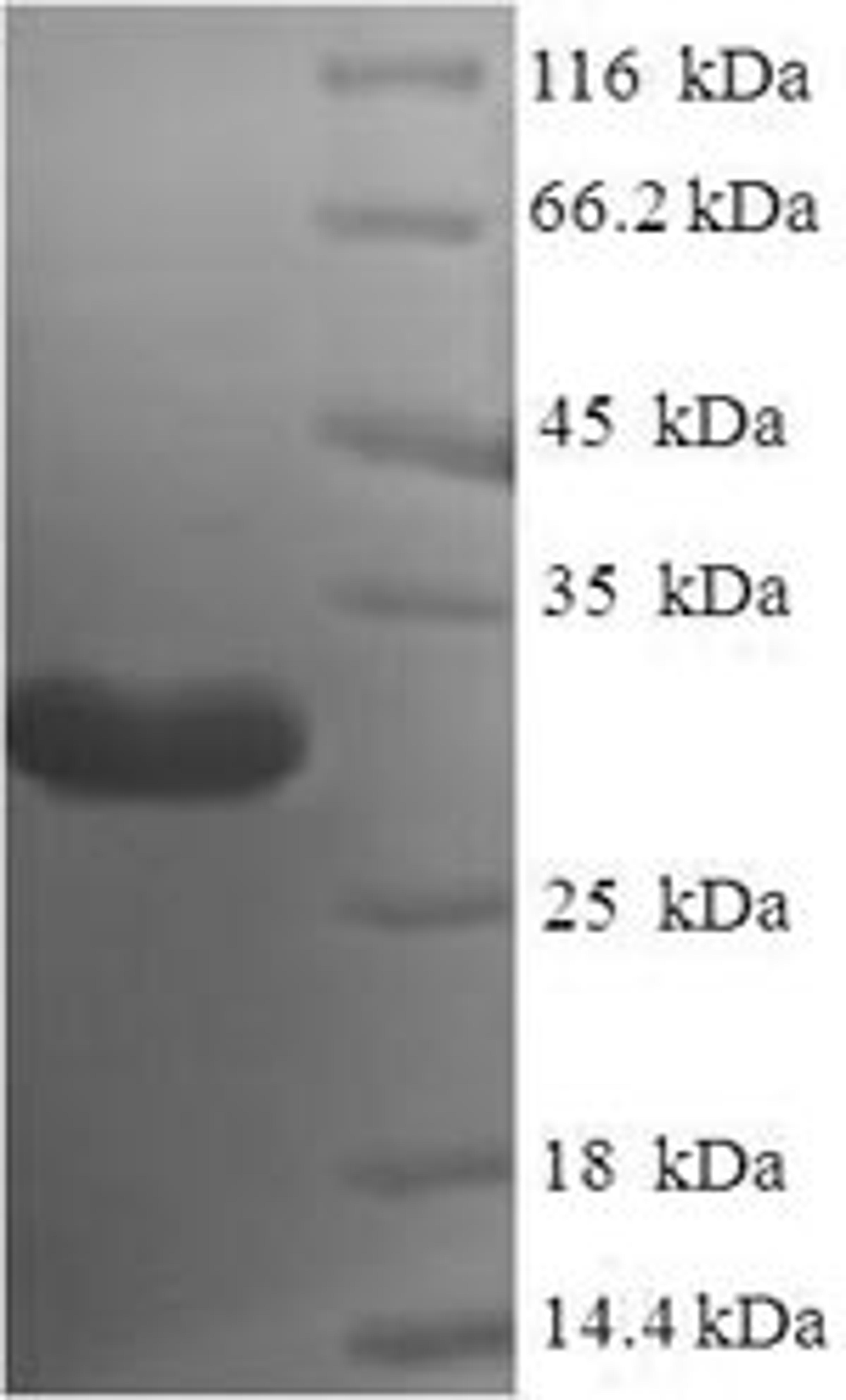 (Tris-Glycine gel) Discontinuous SDS-PAGE (reduced) with 5% enrichment gel and 15% separation gel.