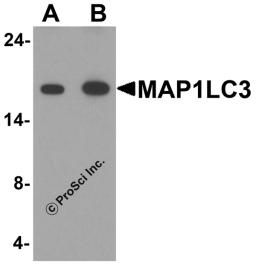 Western blot analysis of MAP1LC3 in human brain tissue lysate with MAP1LC3 antibody at (A) 1 and (B) 2 μg/ml.