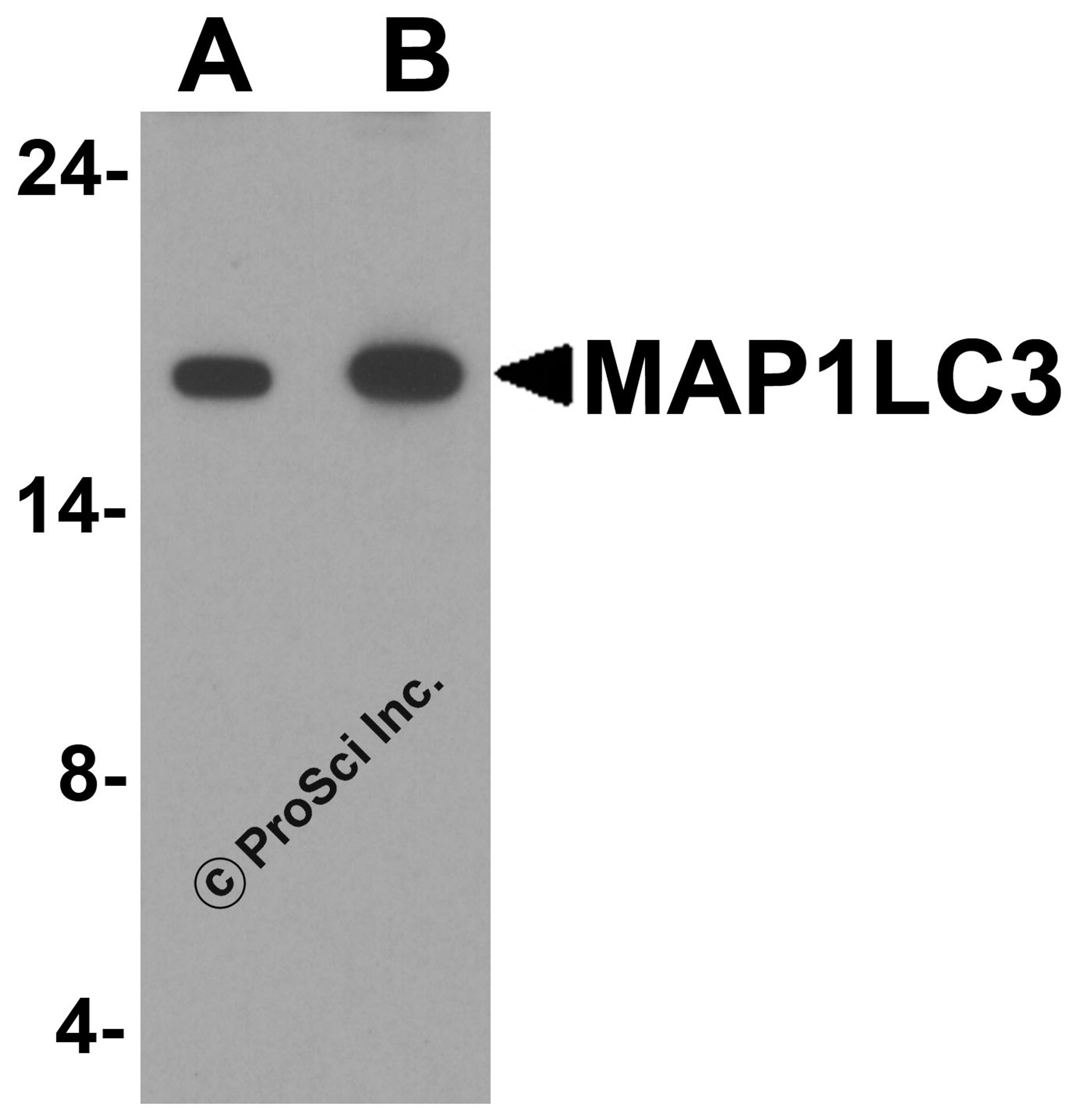 Western blot analysis of MAP1LC3 in human brain tissue lysate with MAP1LC3 antibody at (A) 1 and (B) 2 μg/ml.