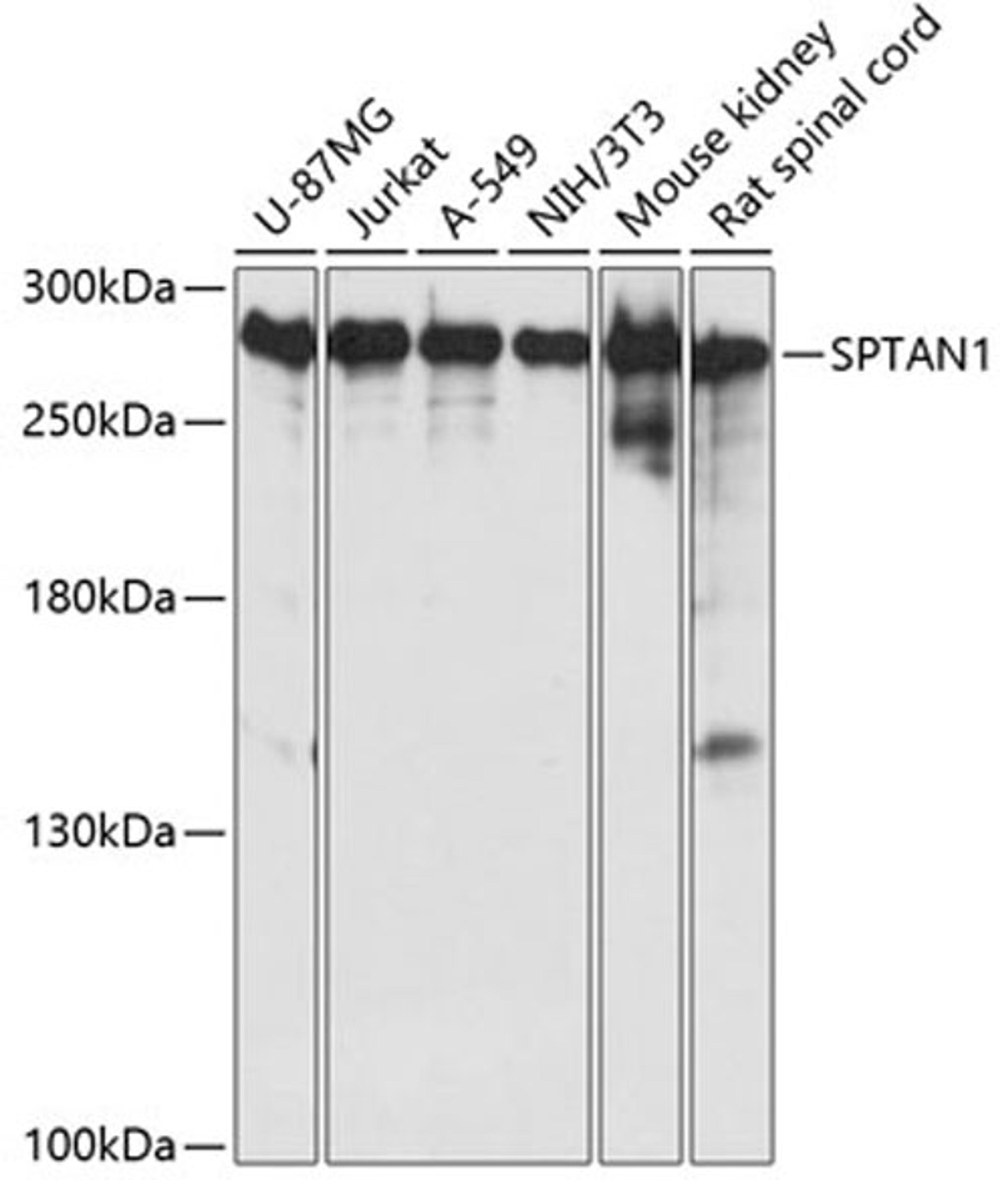 Western blot - SPTAN1 antibody (A0160)