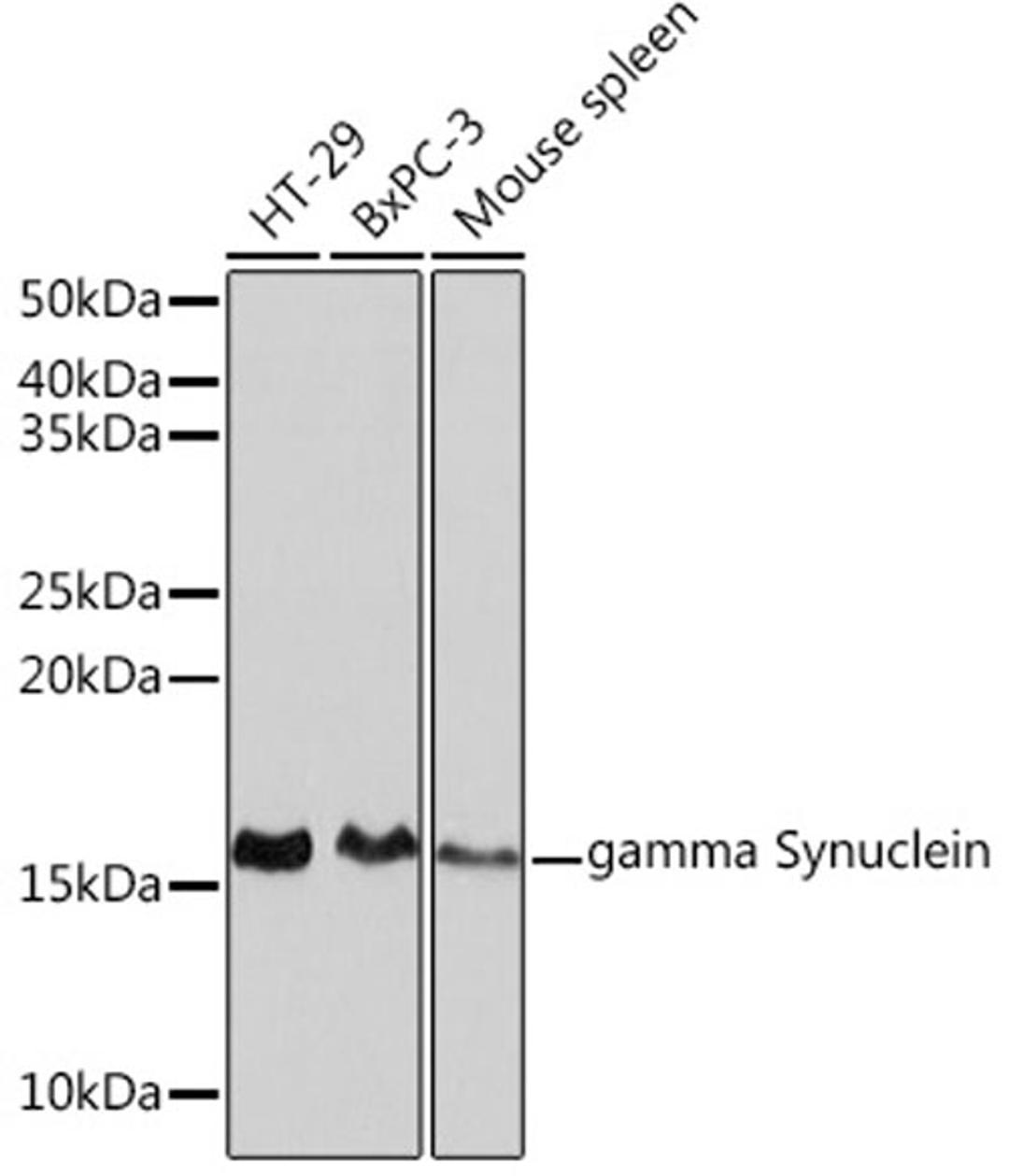 Western blot - gamma Synuclein  Rabbit mAb (A2735)