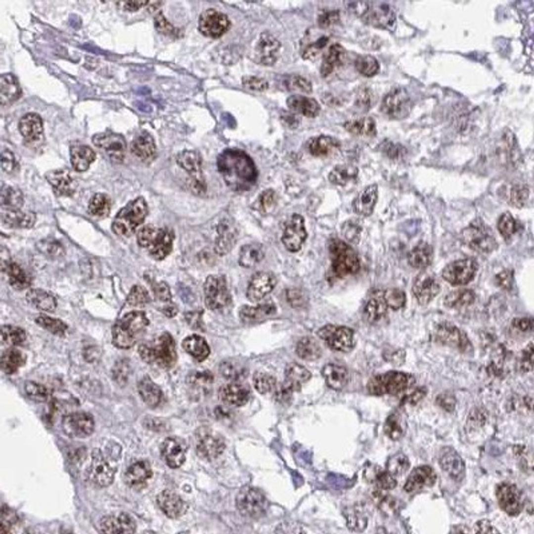 Immunohistochemistry: MED9 Antibody [NBP2-31639] - testis cancer