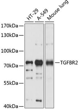 Western blot - TGFBR2 antibody (A11765)