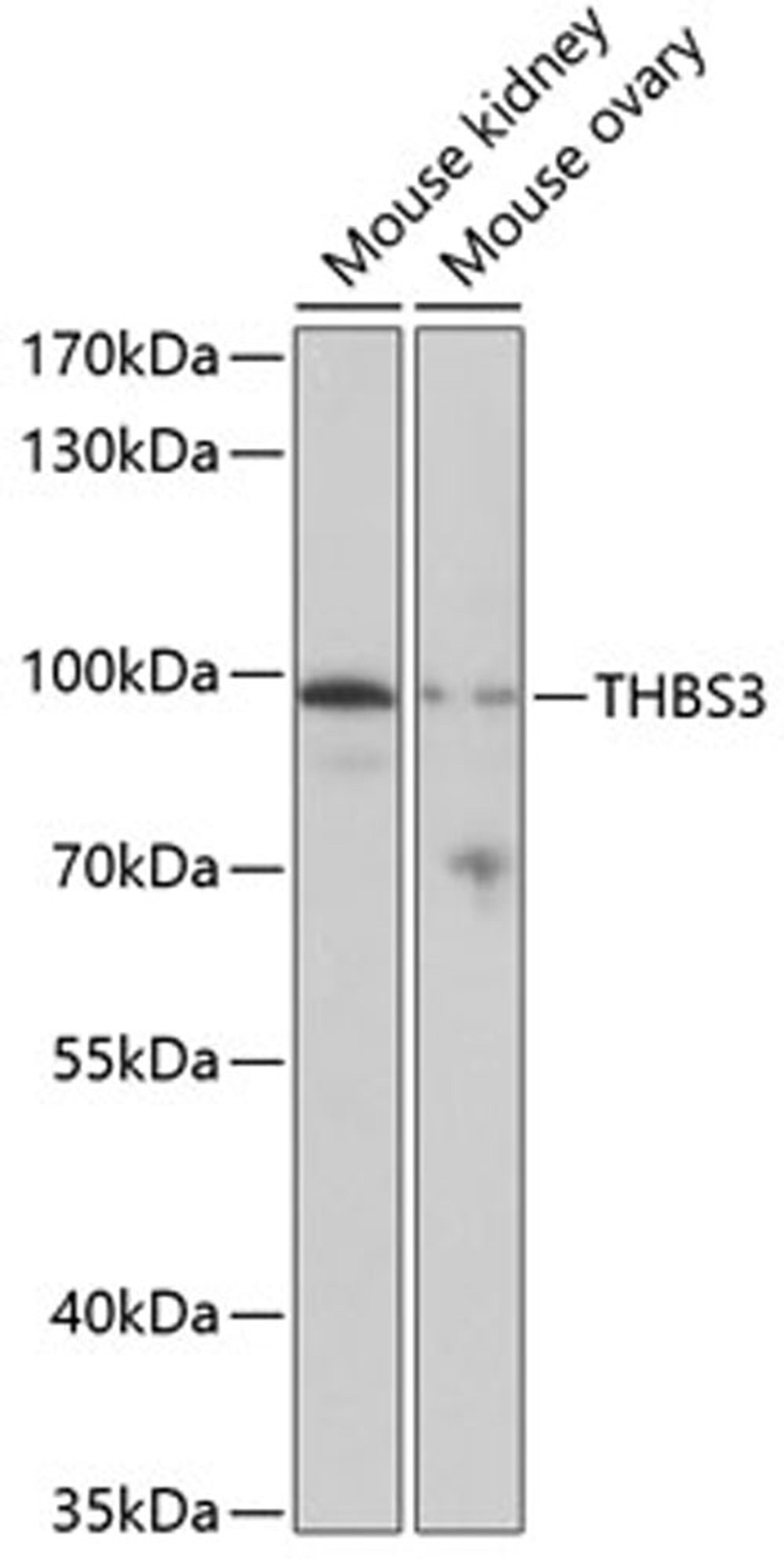 Western blot - THBS3 antibody (A3641)