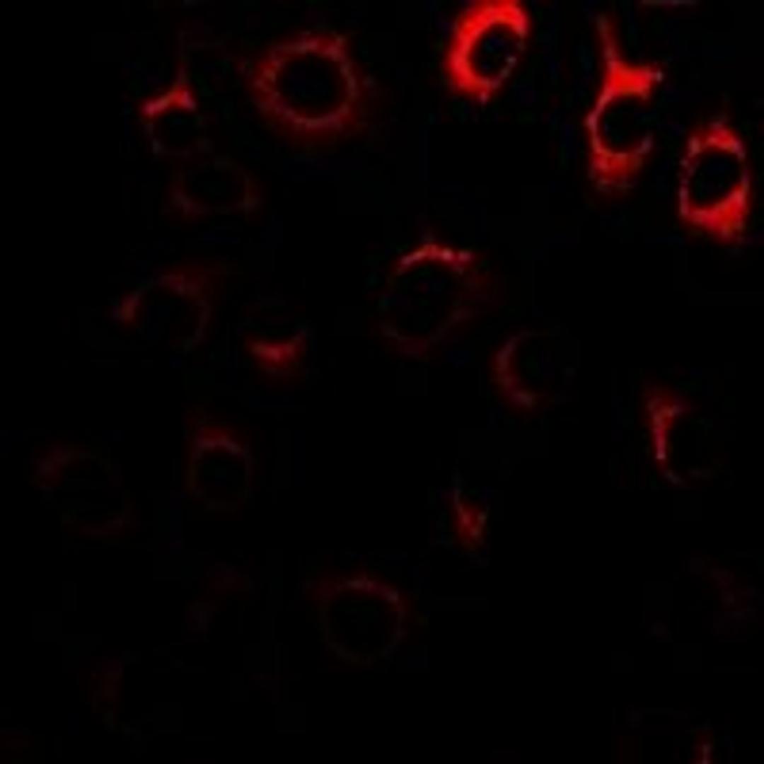 Immunofluorescent analysis of A549 cells using MAGED1 antibody