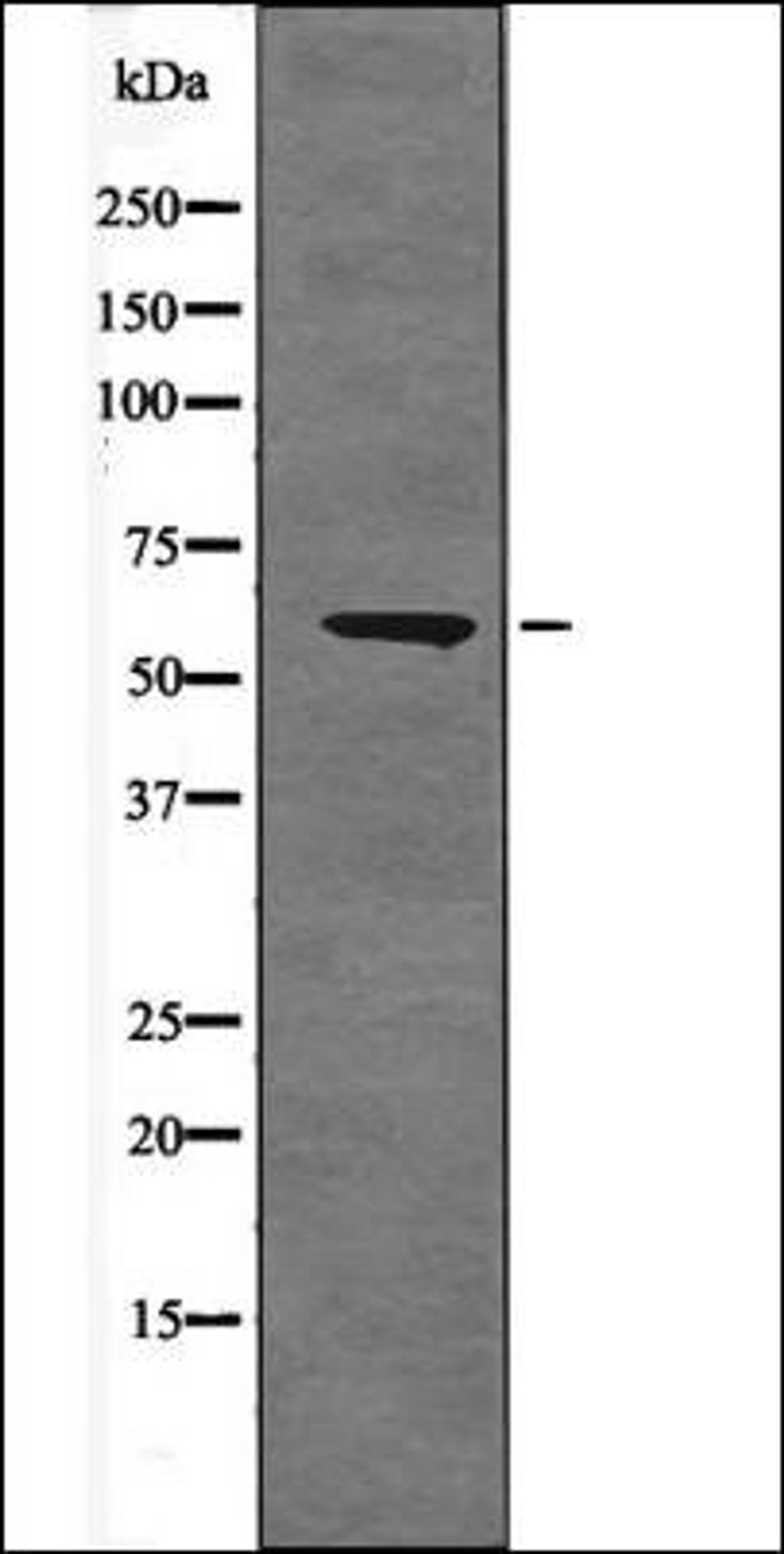 Western blot analysis of Forskolin treated 293 whole cell lysates using BORA -Phospho-Ser497- antibody