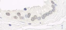 Detection of human Haspin by immunohistochemistry.