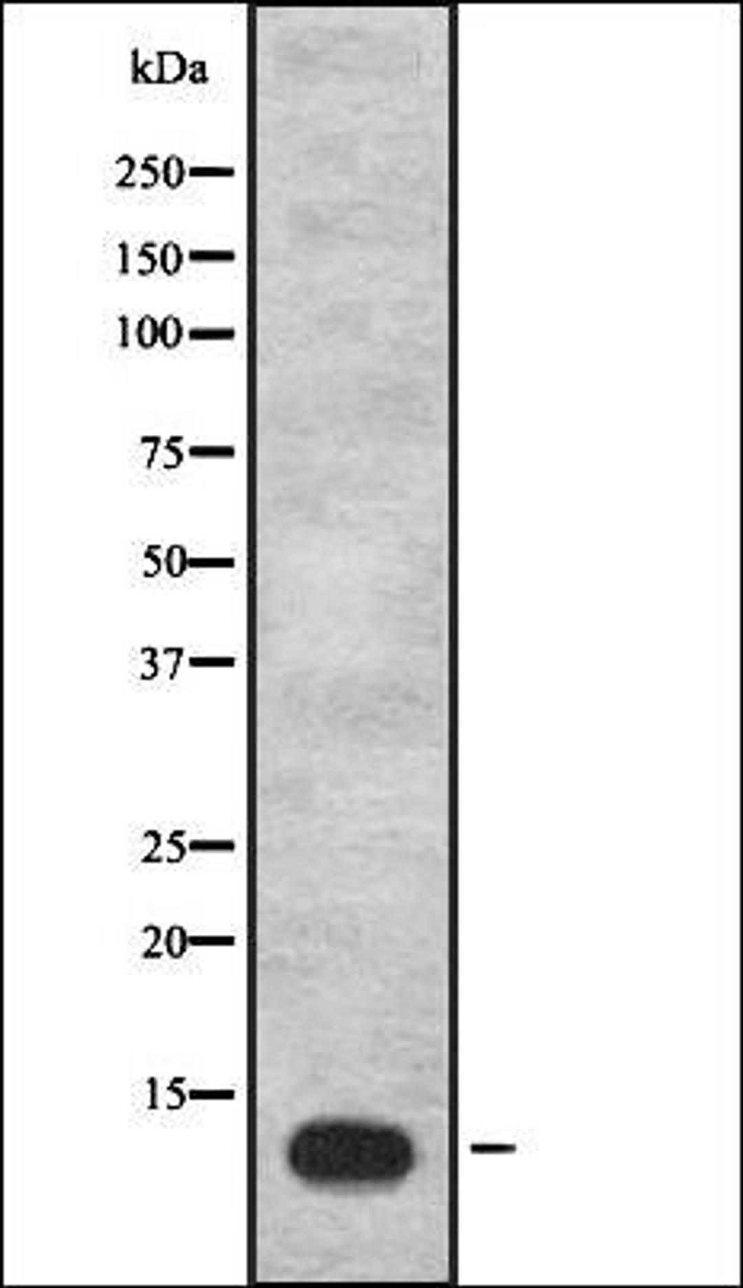 Western blot analysis of Hela cell lysate using IGFL1 antibody