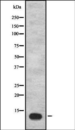 Western blot analysis of Hela cell lysate using IGFL1 antibody