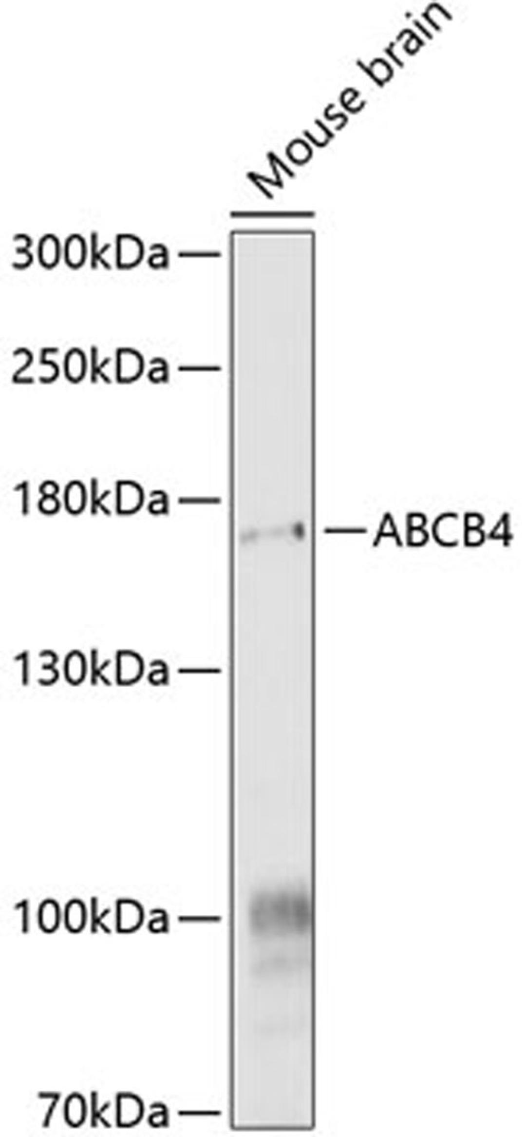 Western blot - ABCB4 antibody (A9835)