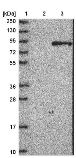 Western Blot: beta Glucuronidase Antibody [NBP1-87511] - Lane 1: Marker [kDa] 250, 130, 95, 72, 55, 36, 28, 17, 10<br/>Lane 2: Negative control (vector only transfected HEK293T lysate)<br/>Lane 3: Over-expression lysate (Co-expressed with a C-terminal myc-DDK tag (~3.1 kDa) in mammalian HEK293T cells, LY400064)