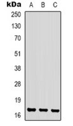 Western blot analysis of Jurkat (Lane 1), K562 (Lane 2), NIH3T3 (Lane 3) whole cell lysates using CKLF1 antibody