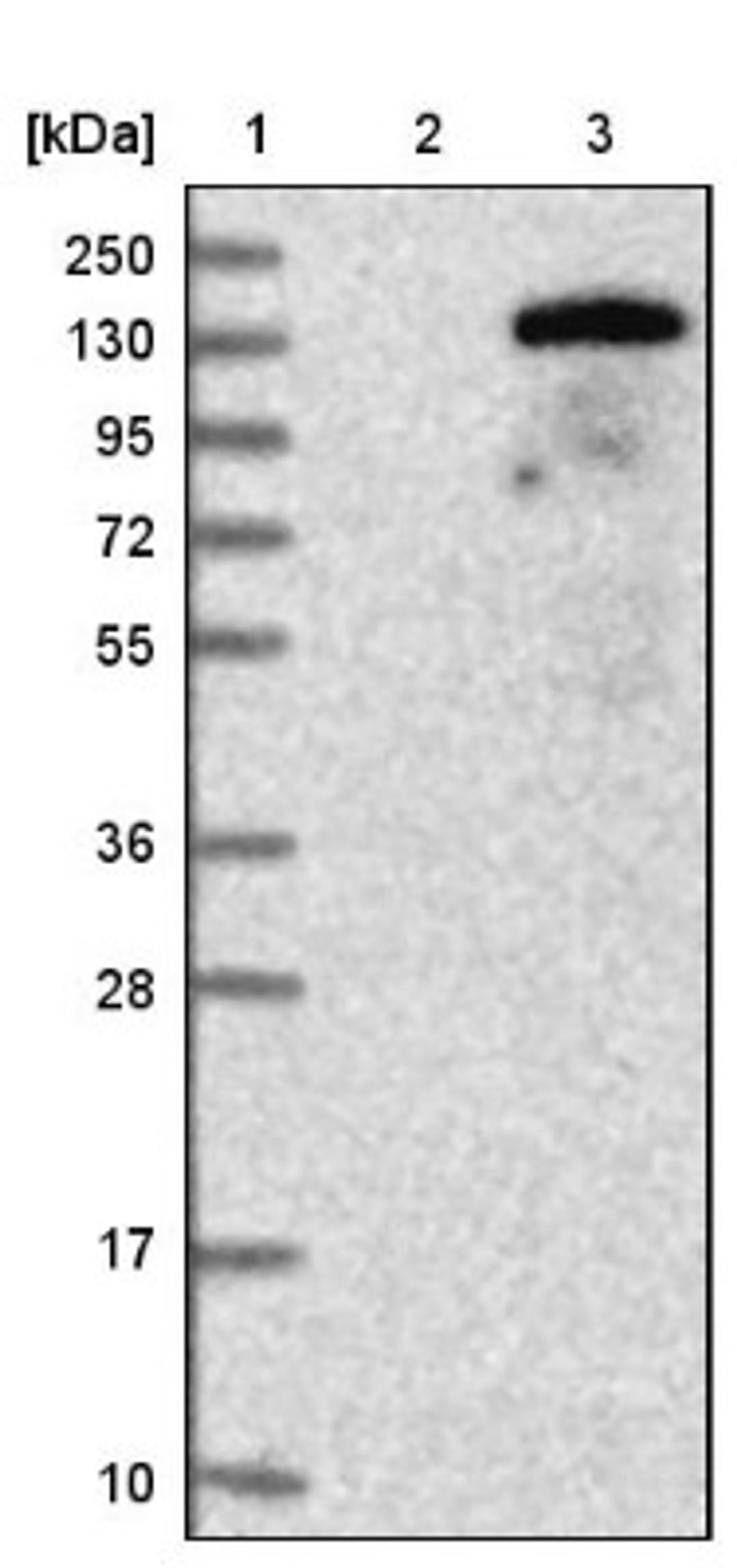 Western Blot: EPH Receptor A6 Antibody [NBP2-13964] - Lane 1: Marker [kDa] 250, 130, 95, 72, 55, 36, 28, 17, 10<br/>Lane 2: Negative control (vector only transfected HEK293T lysate)<br/>Lane 3: Over-expression lysate (Co-expressed with a C-terminal myc-DDK tag (~3.1 kDa) in mammalian HEK293T cells, LY400431)